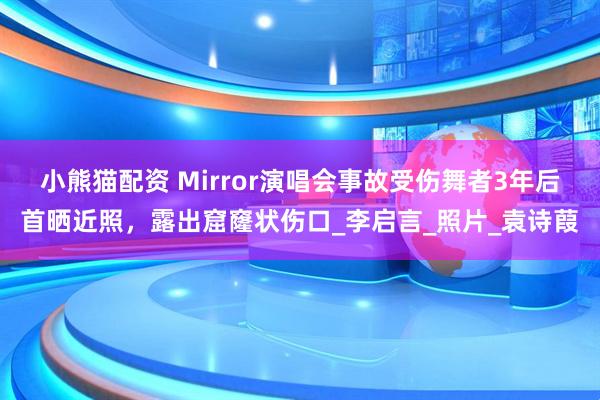 小熊猫配资 Mirror演唱会事故受伤舞者3年后首晒近照，露出窟窿状伤口_李启言_照片_袁诗葭